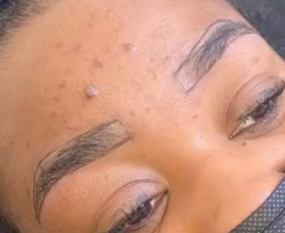 Permanent Make-up Before & After Gallery - Patient 176657368 - Image 1