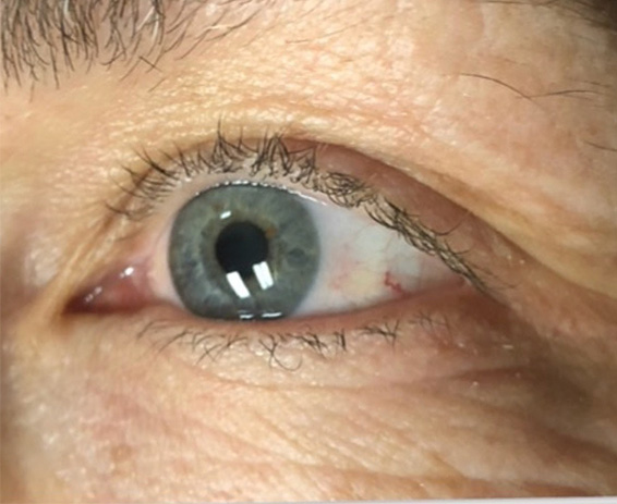 Permanent Make-up Before & After Gallery - Patient 176657375 - Image 1