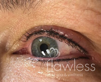 Permanent Make-up Before & After Gallery - Patient 176657375 - Image 2
