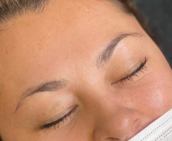 Permanent Make-up Before & After Gallery - Patient 176657367 - Image 1