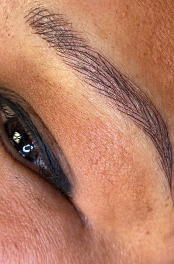 Permanent Make-up Before & After Gallery - Patient 176657383 - Image 2