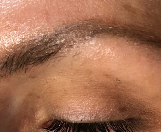 Permanent Make-up Before & After Gallery - Patient 176657377 - Image 1