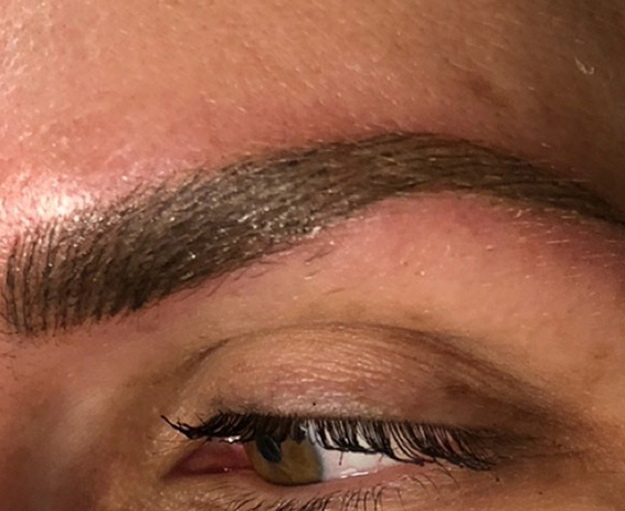 Permanent Make-up Before & After Gallery - Patient 176657377 - Image 2