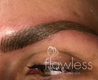 Permanent Make-up Before & After Gallery - Patient 176657377 - Image 2