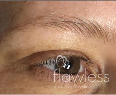 Permanent Make-up Before & After Gallery - Patient 176657379 - Image 1