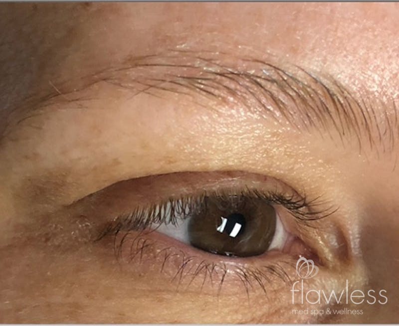 Permanent Make-up Before & After Gallery - Patient 176657379 - Image 1