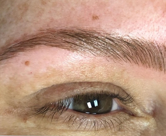 Permanent Make-up Before & After Gallery - Patient 176657379 - Image 2