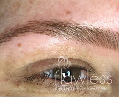 Permanent Make-up Before & After Gallery - Patient 176657379 - Image 2