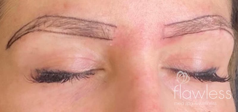 Permanent Make-up Before & After Gallery - Patient 176657376 - Image 1