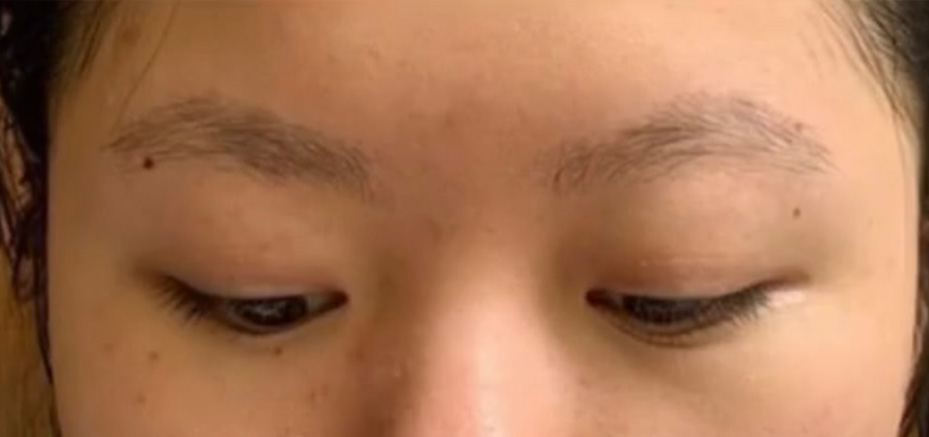 Permanent Make-up Before & After Gallery - Patient 176657371 - Image 1