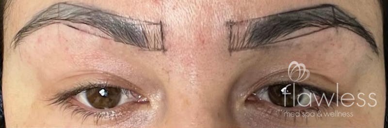 Permanent Make-up Before & After Gallery - Patient 176657372 - Image 1