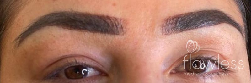 Permanent Make-up Before & After Gallery - Patient 176657372 - Image 2