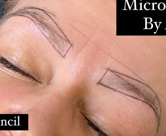 Permanent Make-up Before & After Gallery - Patient 176657369 - Image 1