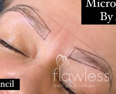 Permanent Make-up Before & After Gallery - Patient 176657369 - Image 1
