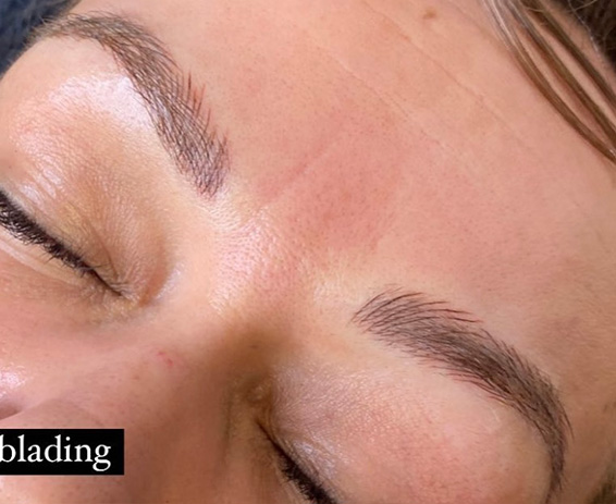 Permanent Make-up Before & After Gallery - Patient 176657369 - Image 2