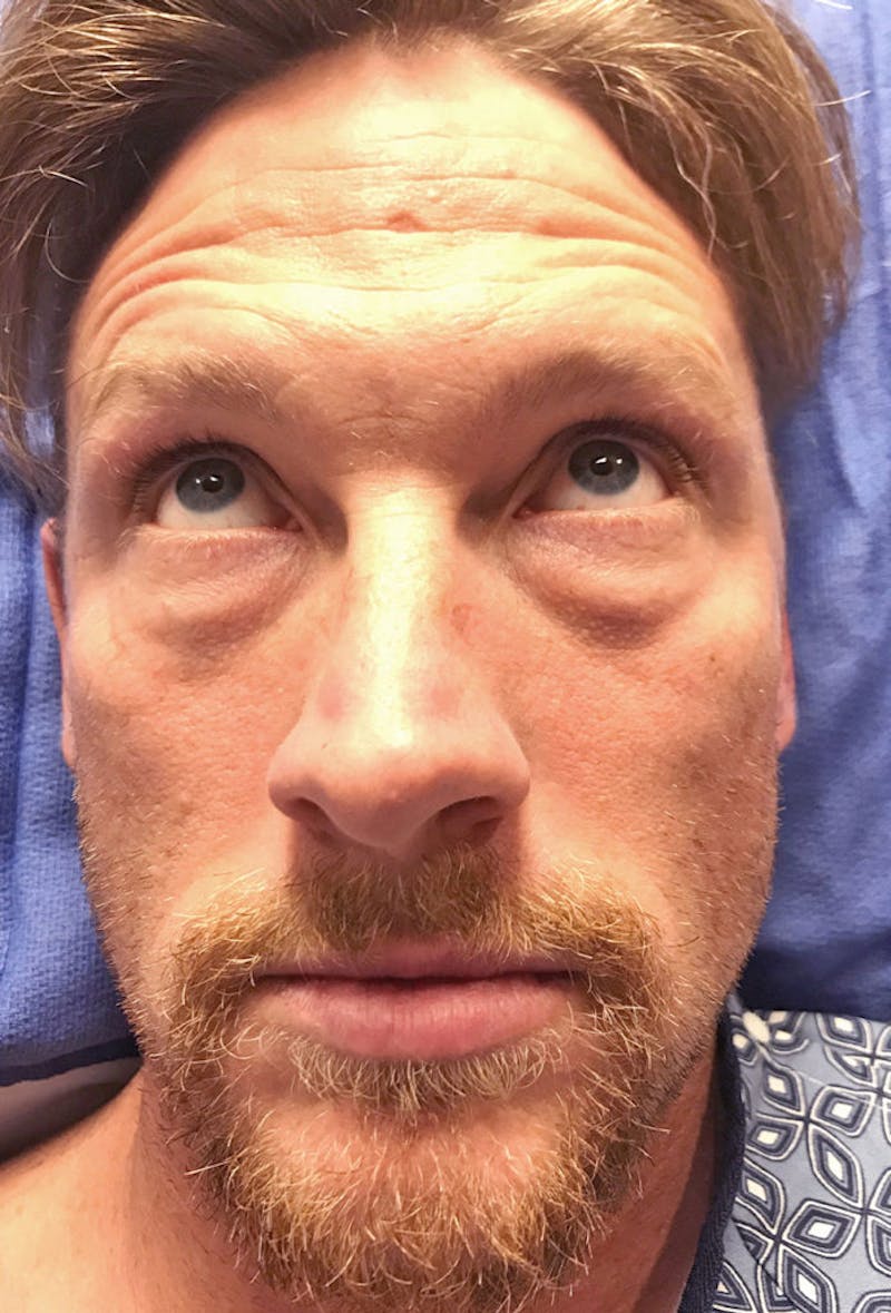 Face Before & After Gallery - Patient 63360267 - Image 3