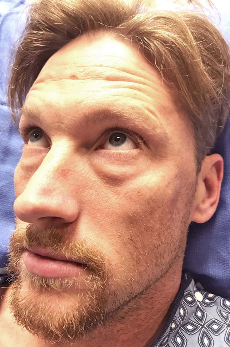 Face Before & After Gallery - Patient 63360267 - Image 5