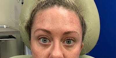 Non-Surgical Before & After Gallery - Patient 63360495 - Image 2