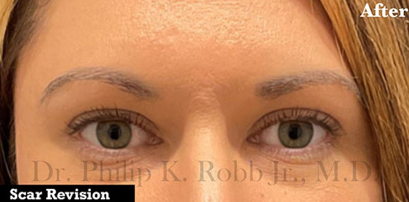 Cosmetic Surgical Before & After Gallery - Patient 63360507 - Image 2