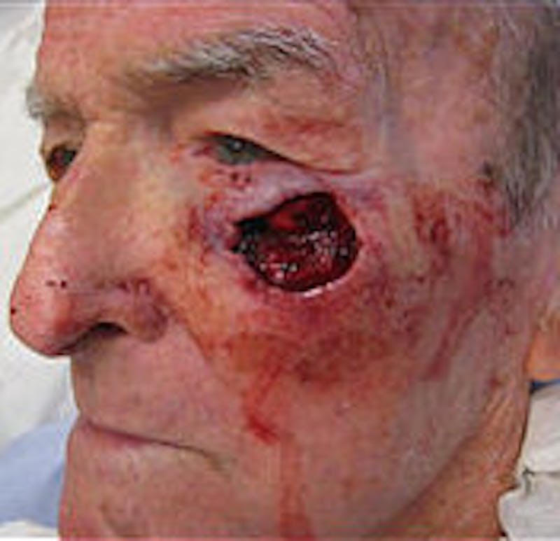 Facial Reconstruction Before & After Gallery - Patient 63360521 - Image 1