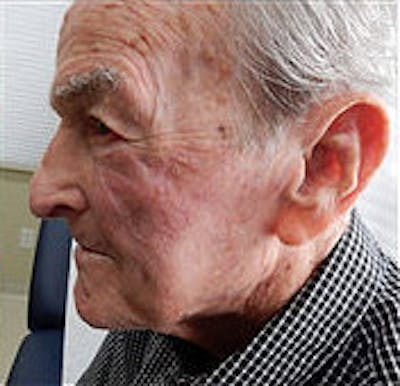 Facial Reconstruction Before & After Gallery - Patient 63360521 - Image 2