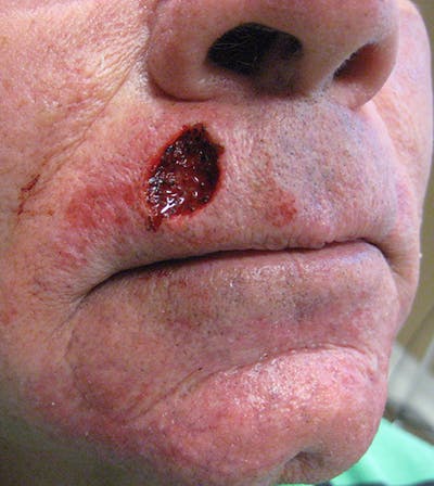 Facial Reconstruction Before & After Gallery - Patient 63360524 - Image 1