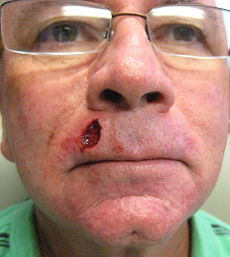 Facial Reconstruction Before & After Gallery - Patient 63360524 - Image 3