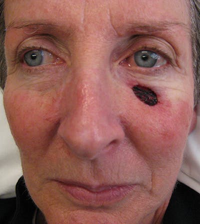 Facial Reconstruction Before & After Gallery - Patient 63360527 - Image 1