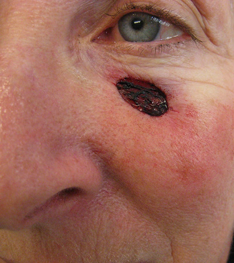 Facial Reconstruction Before & After Gallery - Patient 63360527 - Image 3