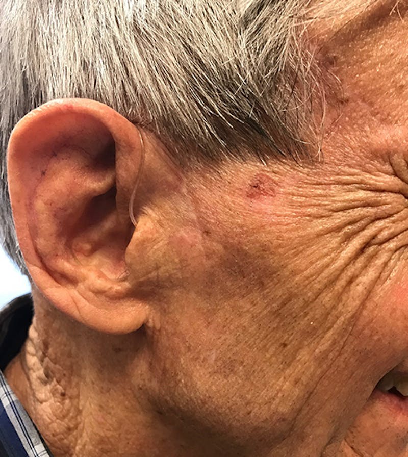 Facial Reconstruction Before & After Gallery - Patient 63360535 - Image 4