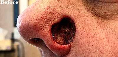 Facial Reconstruction Before & After Gallery - Patient 63360542 - Image 1