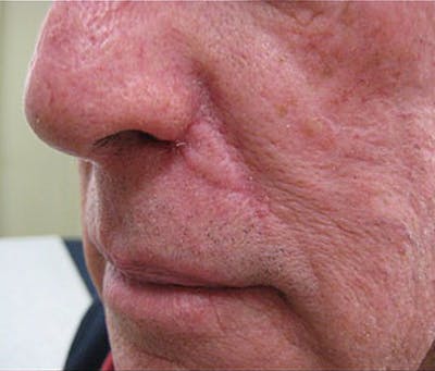 Facial Reconstruction Before & After Gallery - Patient 63360544 - Image 2