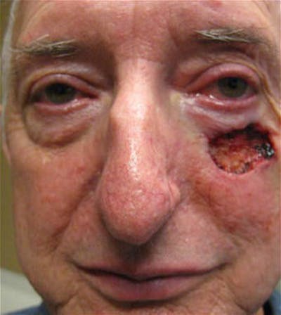 Facial Reconstruction Before & After Gallery - Patient 63360554 - Image 1