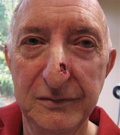 Facial Reconstruction Before & After Gallery - Patient 63360554 - Image 2