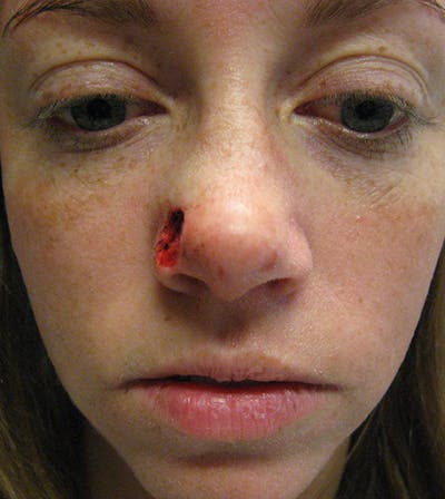 Facial Reconstruction Before & After Gallery - Patient 63360559 - Image 1