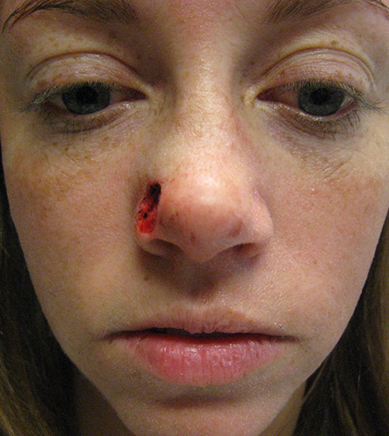 Facial Reconstruction Before & After Gallery - Patient 63360559 - Image 1