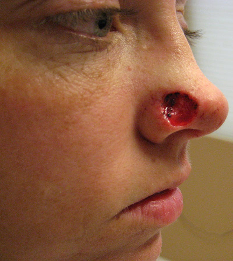 Facial Reconstruction Before & After Gallery - Patient 63360559 - Image 3
