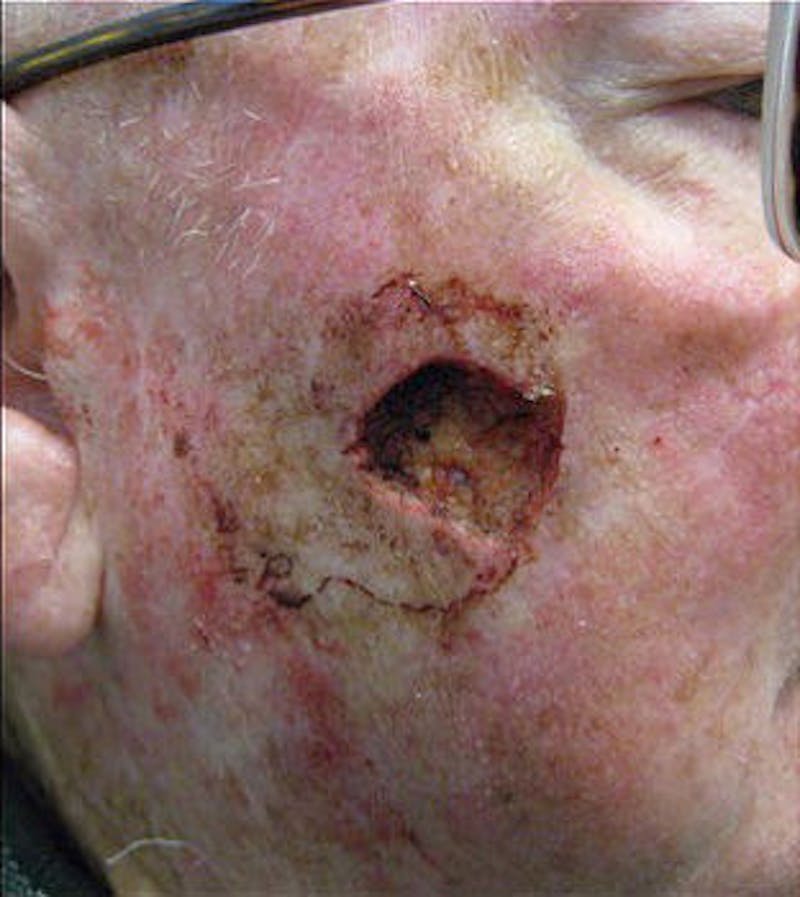 Facial Reconstruction Before & After Gallery - Patient 63360560 - Image 1