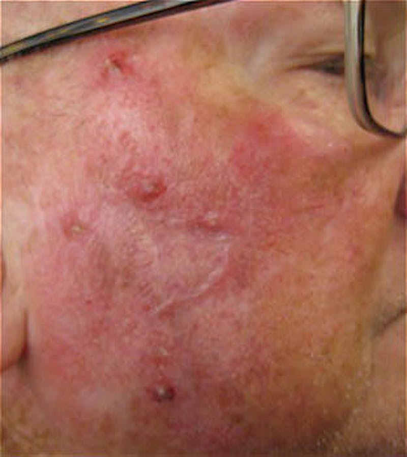 Facial Reconstruction Before & After Gallery - Patient 63360560 - Image 2