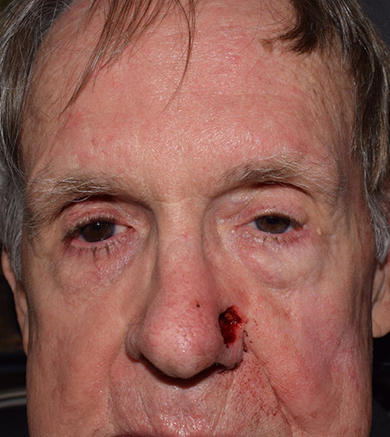 Facial Reconstruction Before & After Gallery - Patient 63360563 - Image 1