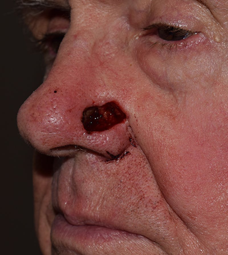 Facial Reconstruction Before & After Gallery - Patient 63360563 - Image 3