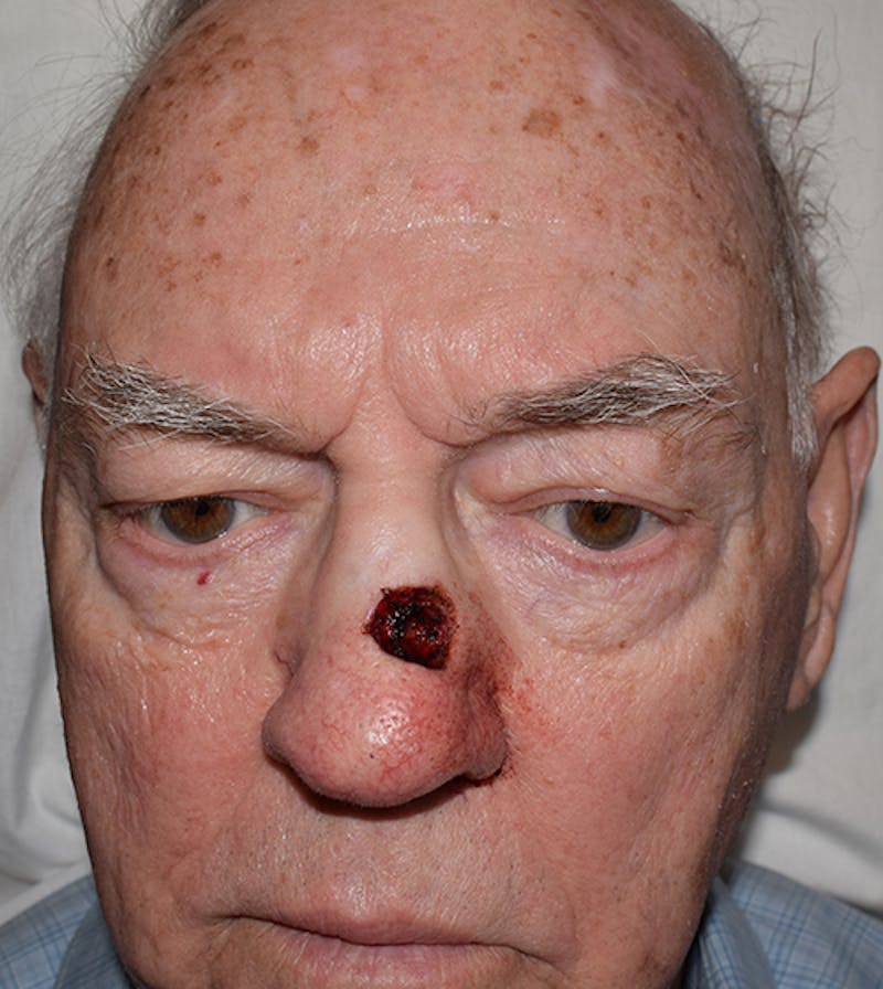 Facial Reconstruction Before & After Gallery - Patient 63360568 - Image 1