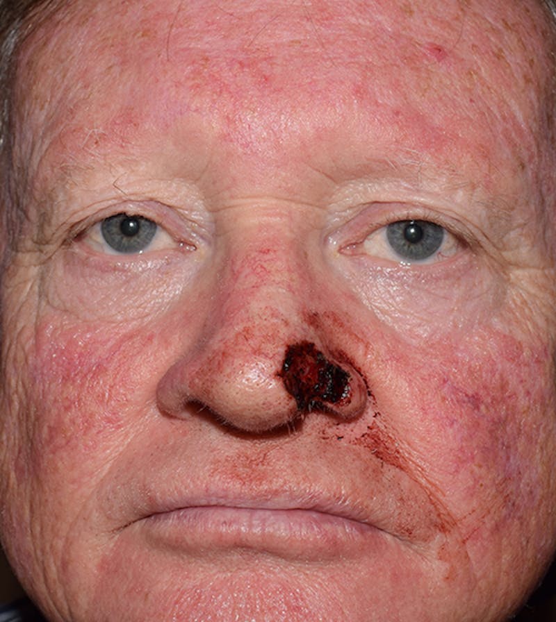Facial Reconstruction Before & After Gallery - Patient 63360570 - Image 1