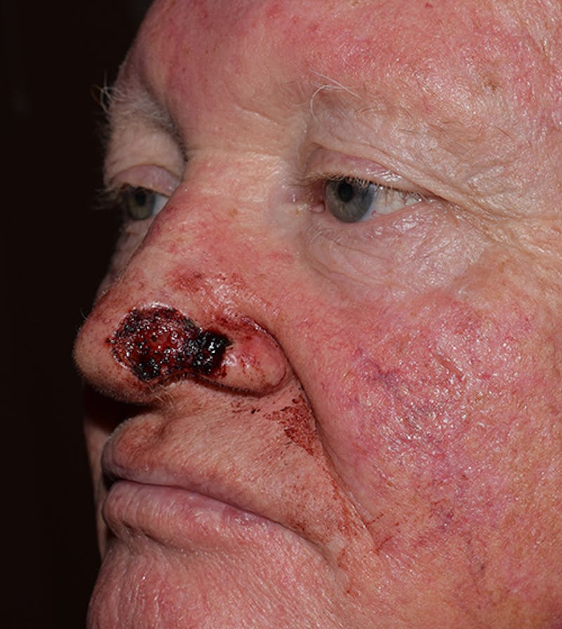 Facial Reconstruction Before & After Gallery - Patient 63360570 - Image 3