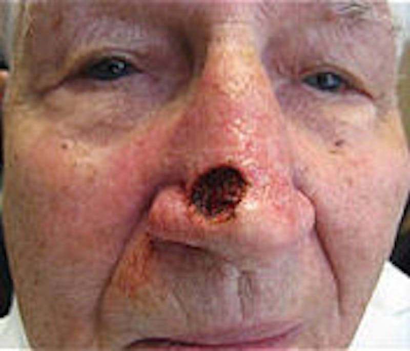 Facial Reconstruction Before & After Gallery - Patient 63360572 - Image 1