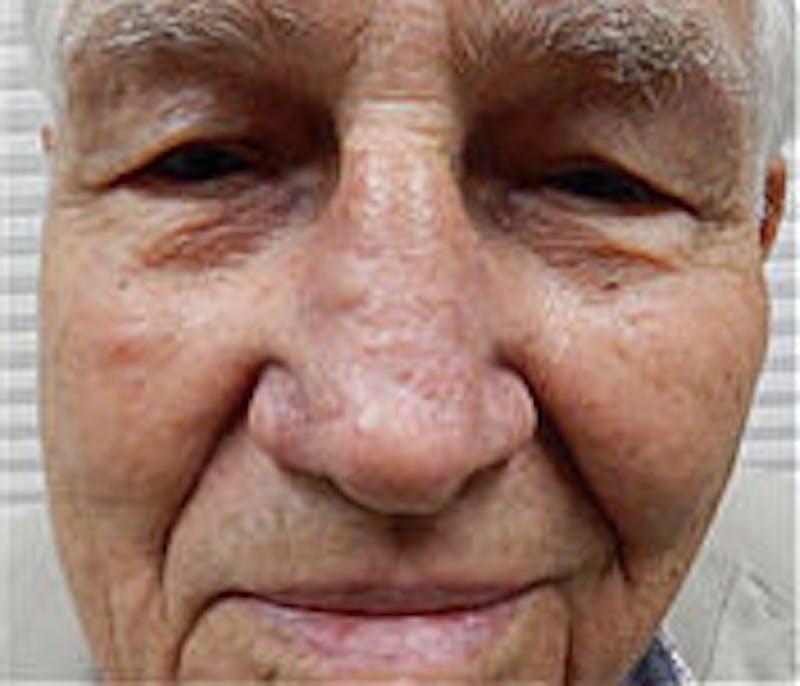 Facial Reconstruction Before & After Gallery - Patient 63360572 - Image 2