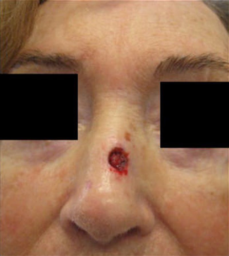 Facial Reconstruction Before & After Gallery - Patient 63360574 - Image 1