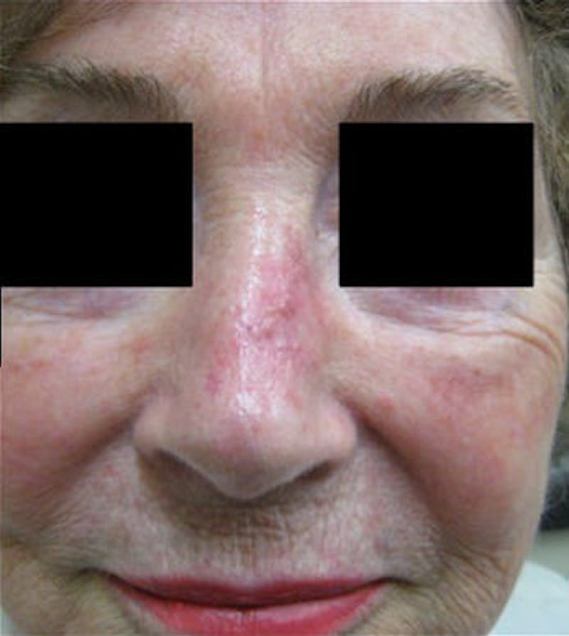 Facial Reconstruction Before & After Gallery - Patient 63360574 - Image 2