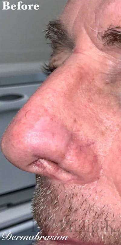 Facial Reconstruction Before & After Gallery - Patient 63360576 - Image 1