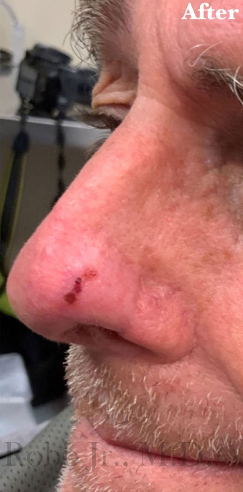 Facial Reconstruction Before & After Gallery - Patient 63360576 - Image 2
